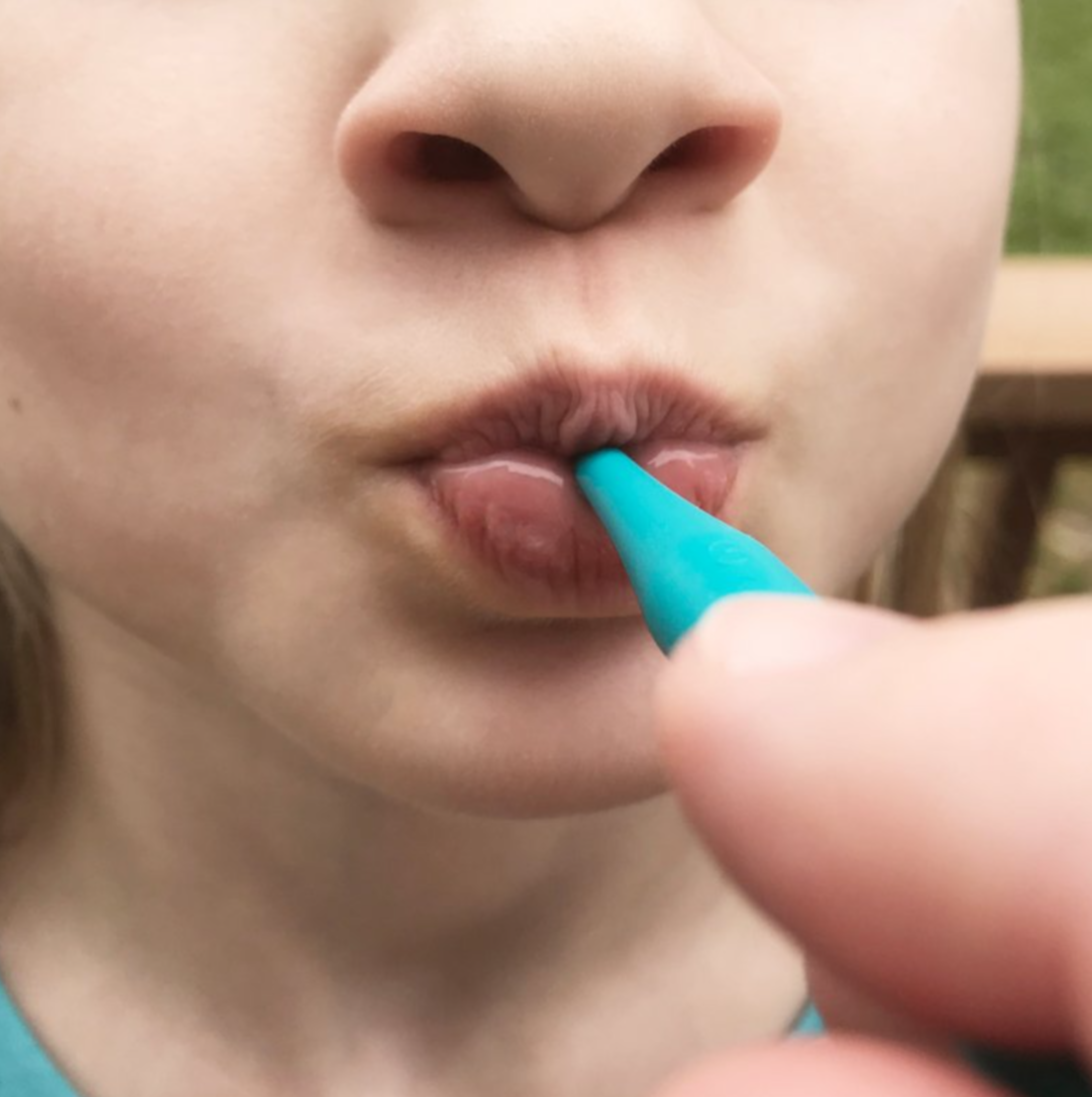 Child using ARK Button Tip for lip closure and strength – NDIS-supported therapy tool for speech and feeding.