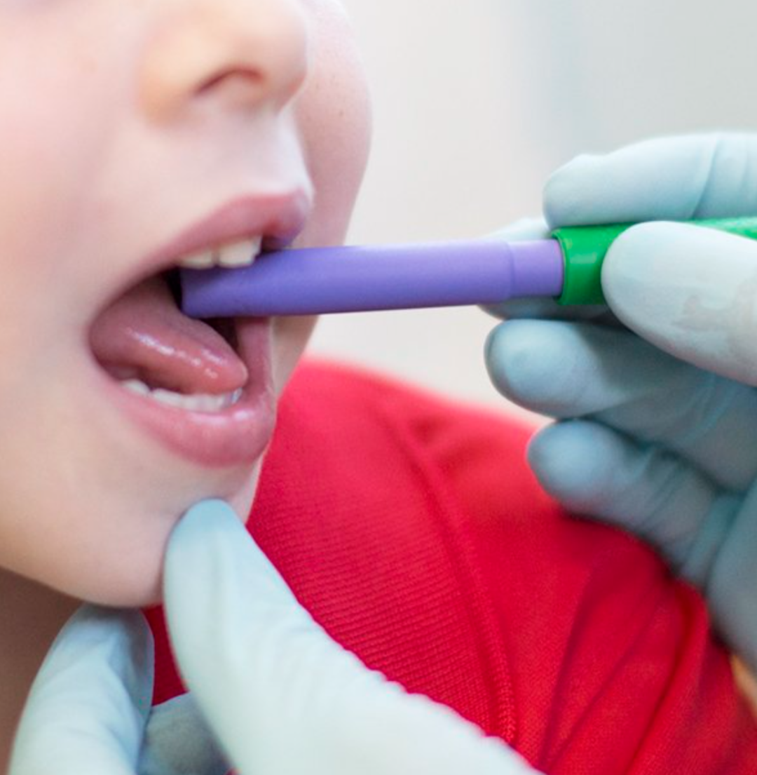 Therapist using ARK Smooth Bite Tube Tip with child during feeding therapy – may be approved for NDIS support.